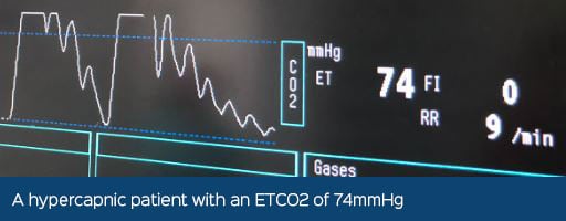 A patient with an ETCO2 of 74mmHg